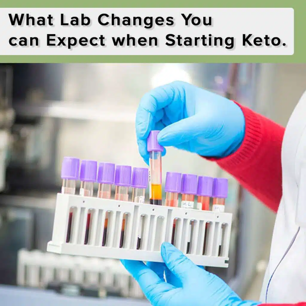 What Lab Changes You can Expect when Starting Keto.