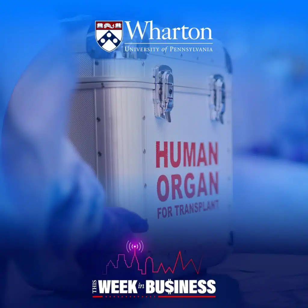 How DMV Questions Shape Organ Donor Registration Decisions