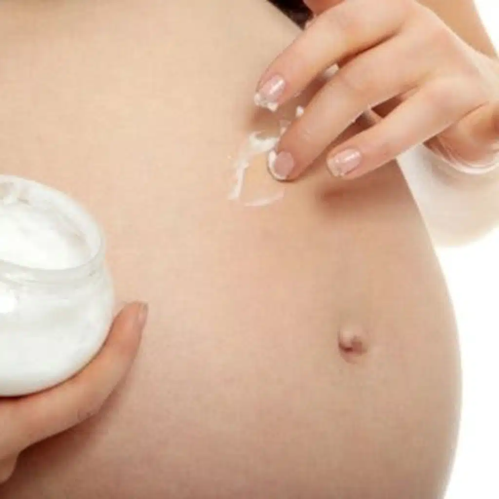 Stretch Marks During Pregnancy