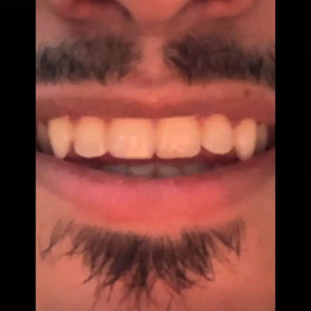 mūśĩĊ (feat. TONY) (YT SAMPLEd Beat by: Versa)