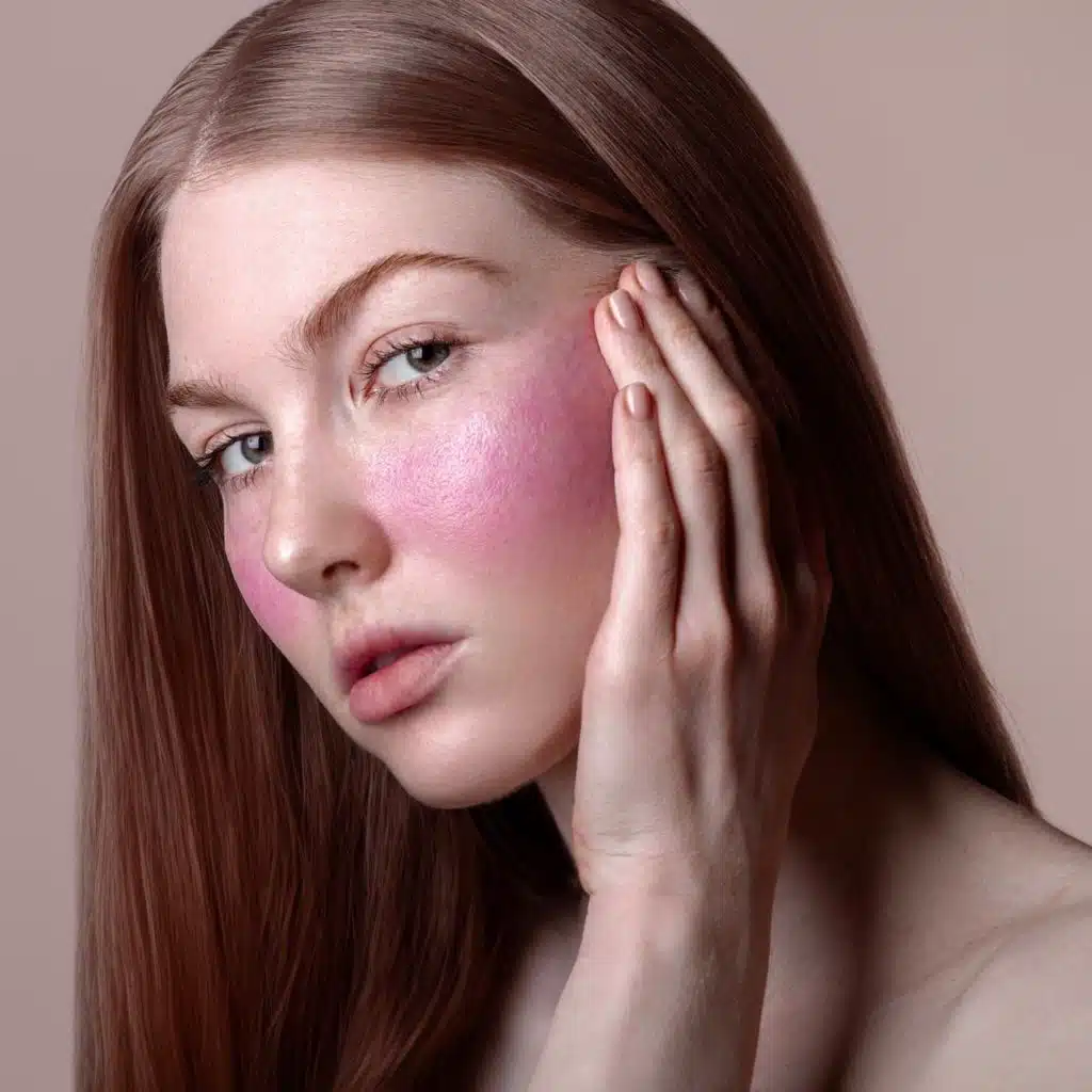 SLP 529: Self Love Quicky - Natural Remedies for Rosacea