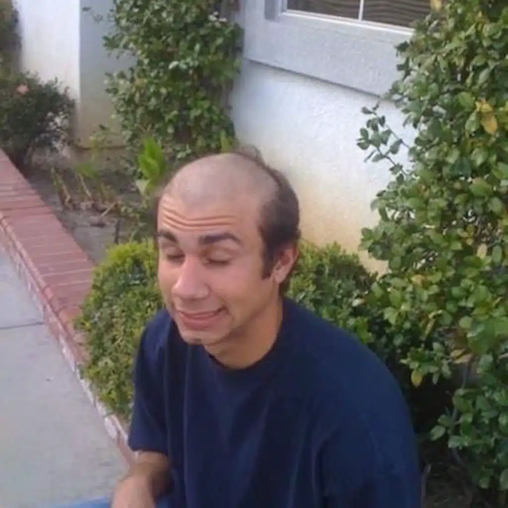 What's Up Balding Beauty?