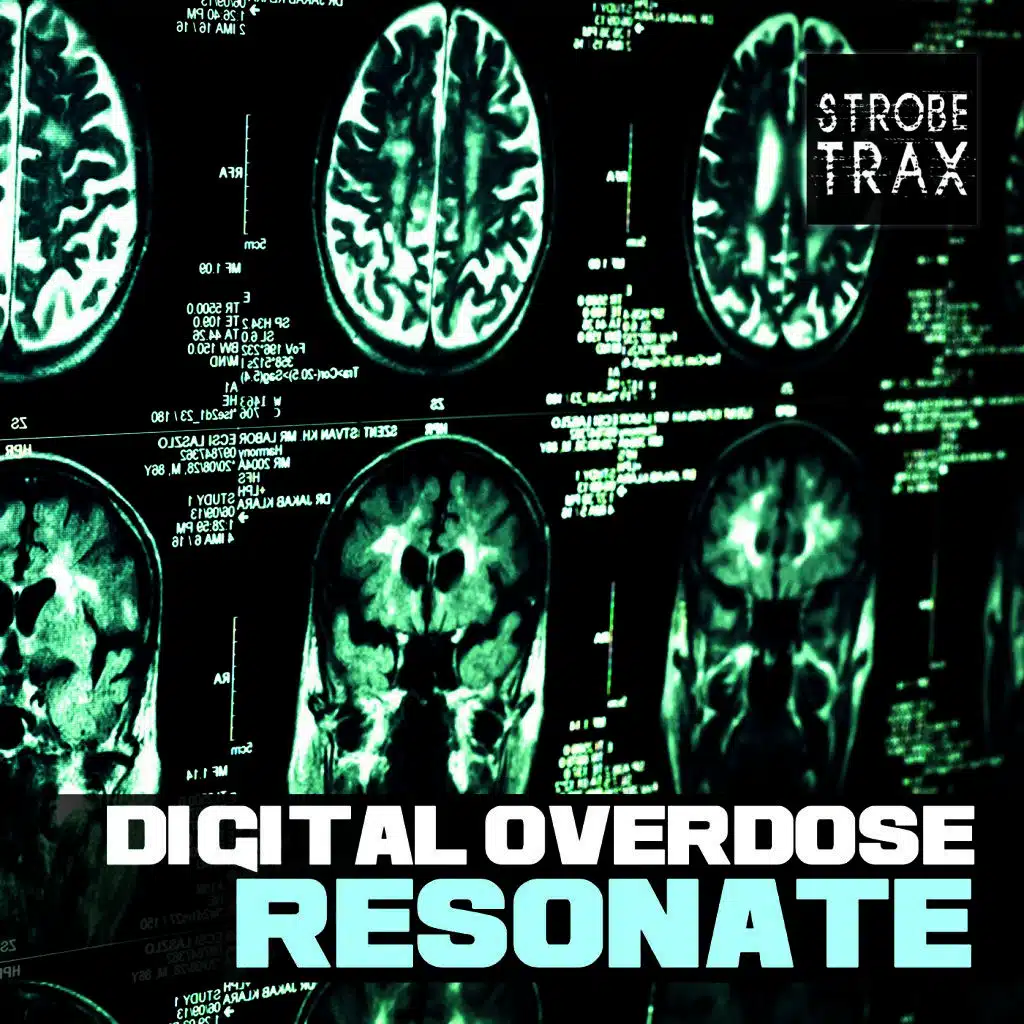 Digital Overdose