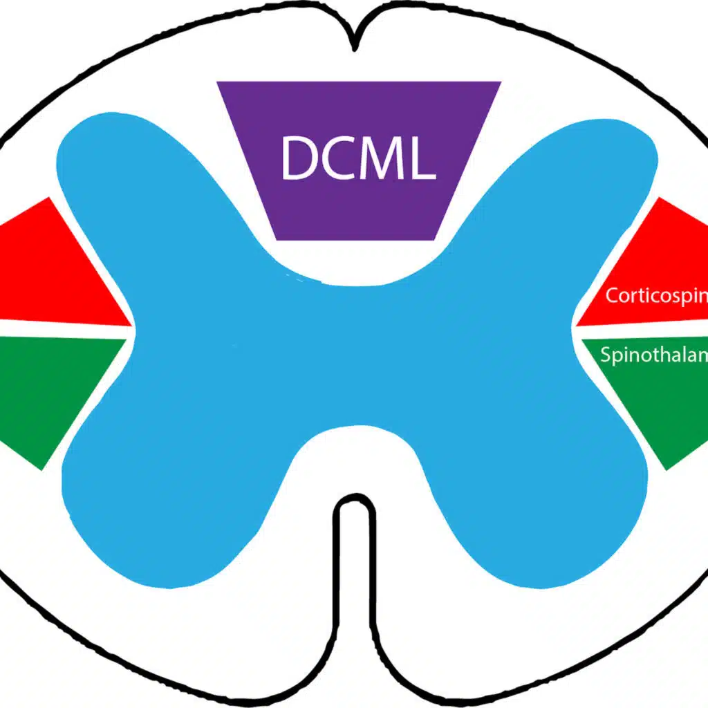 Episode 916: Central Cord Syndrome