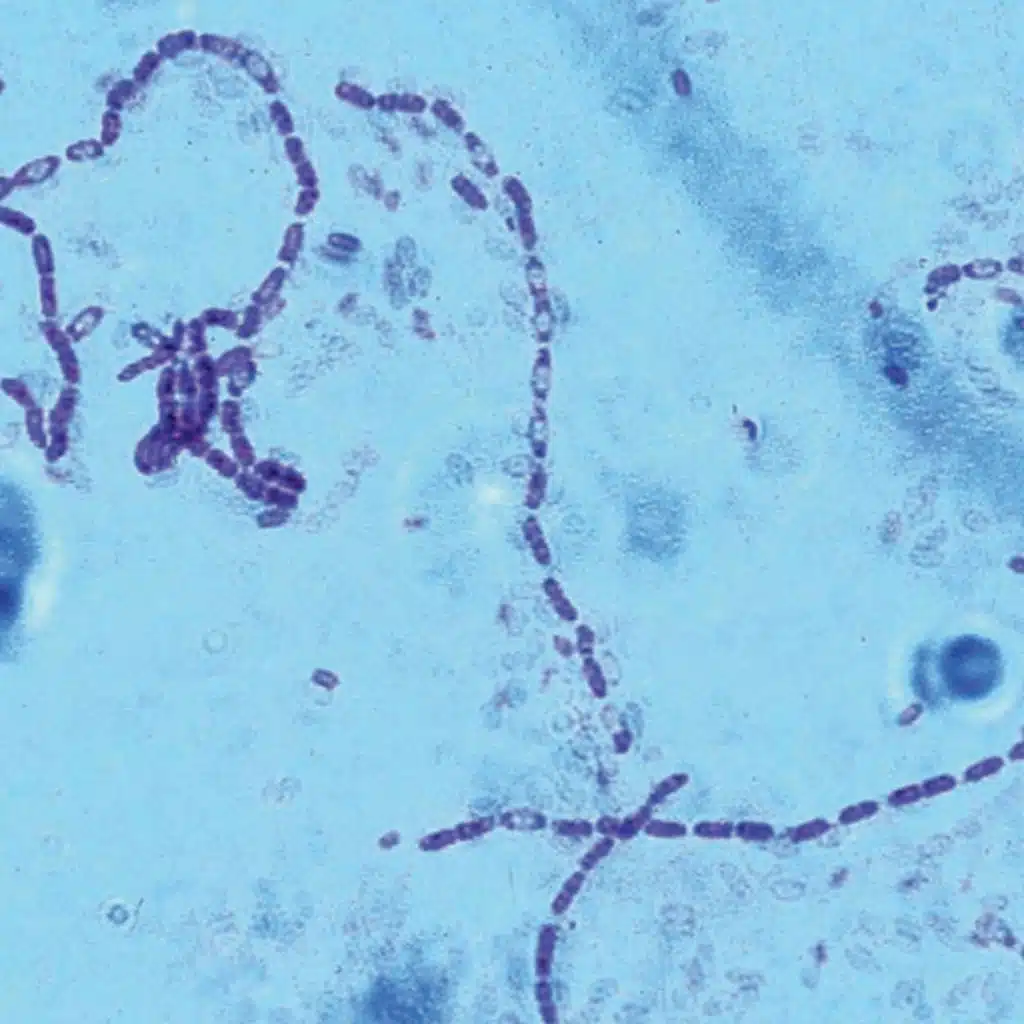  Major Shifts in Bacterial Transcription (CMB part 6)