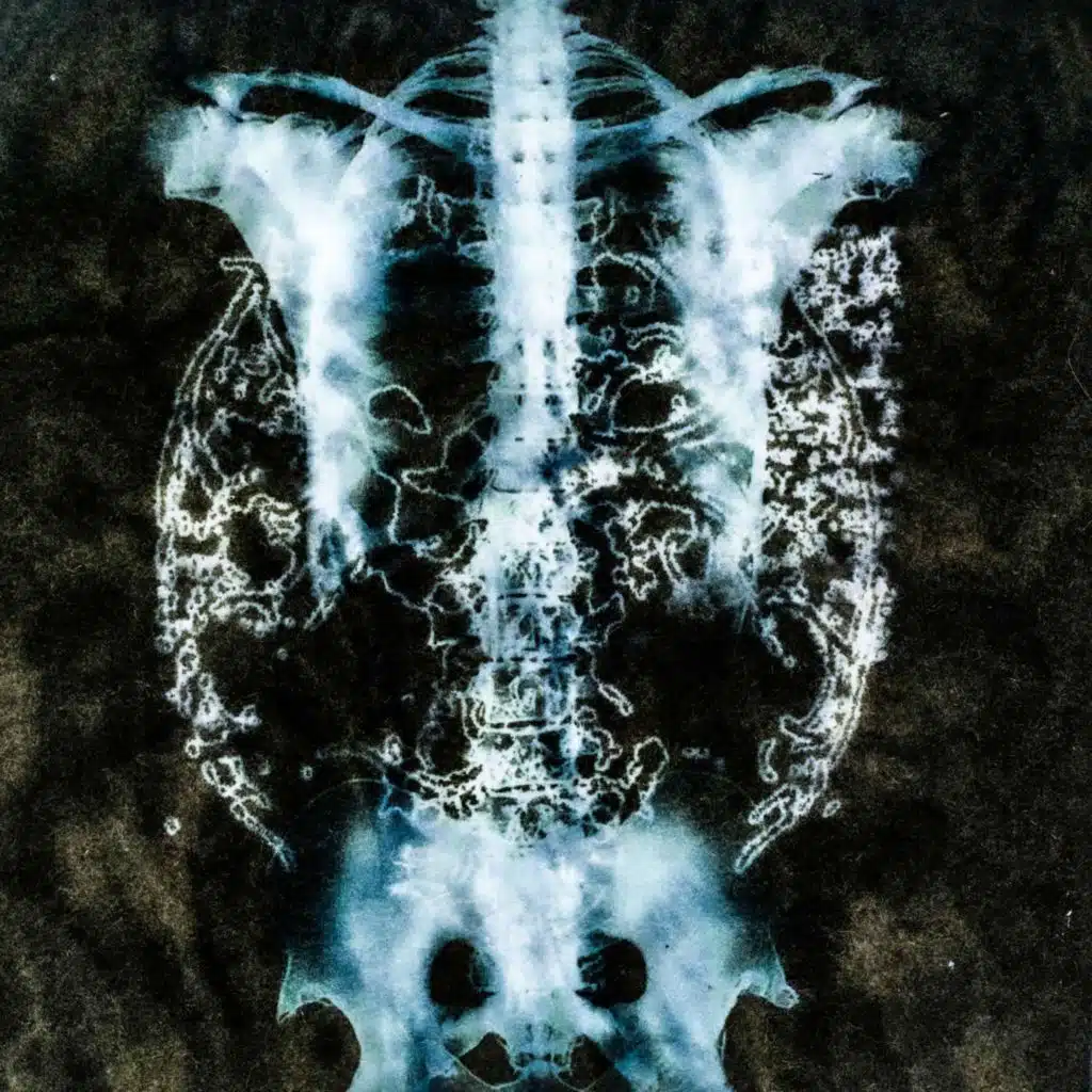 Позвоночник Prod. by Coldbeexgod, messAGE