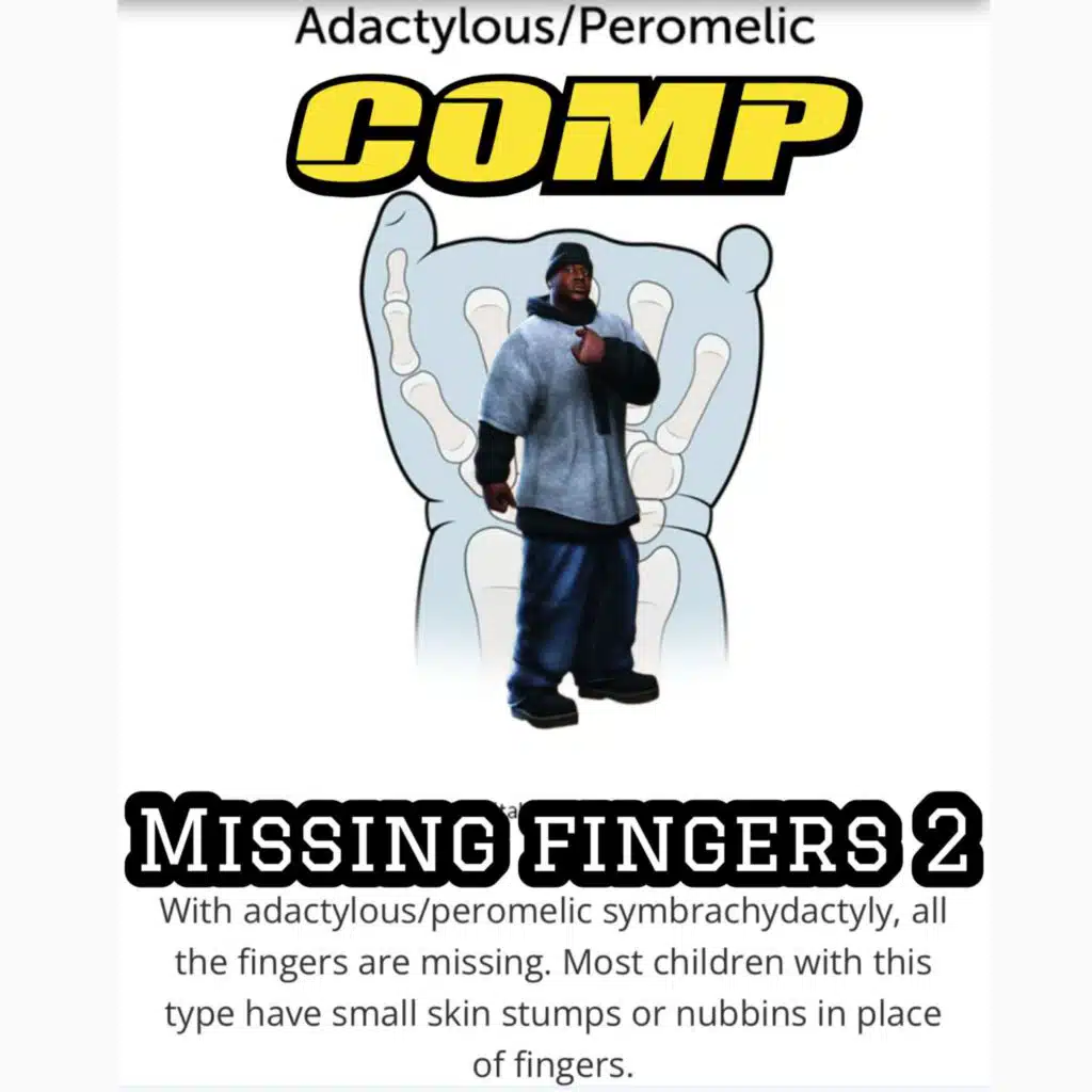 missing fingers 2
