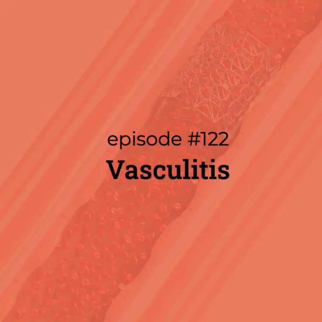 #122 Vasculitis