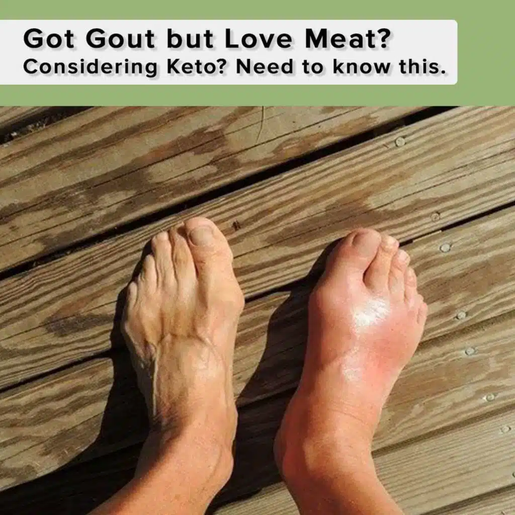 Got Gout but Love Meat? Considering Keto? Need to know this.