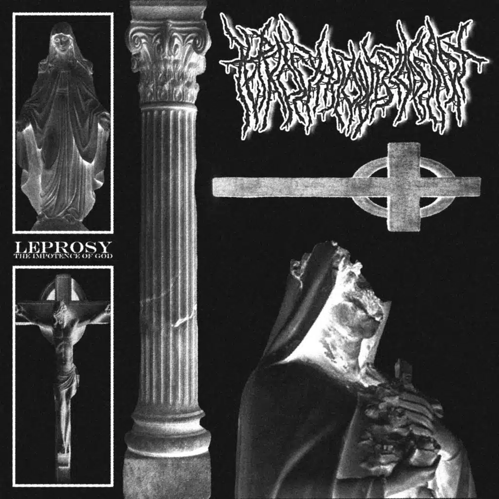 Leprosy