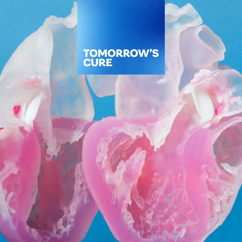 How AI is Transforming Organ Transplants