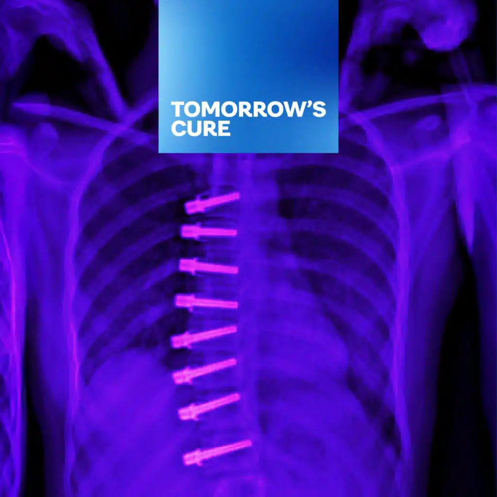 Shaping a New Future for Youth with Scoliosis