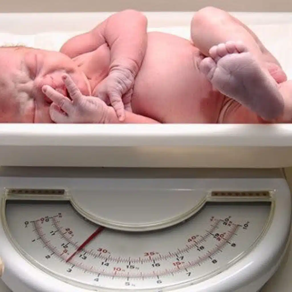 Breastfeeding Your Baby: Losing 10% of Birth Weight
