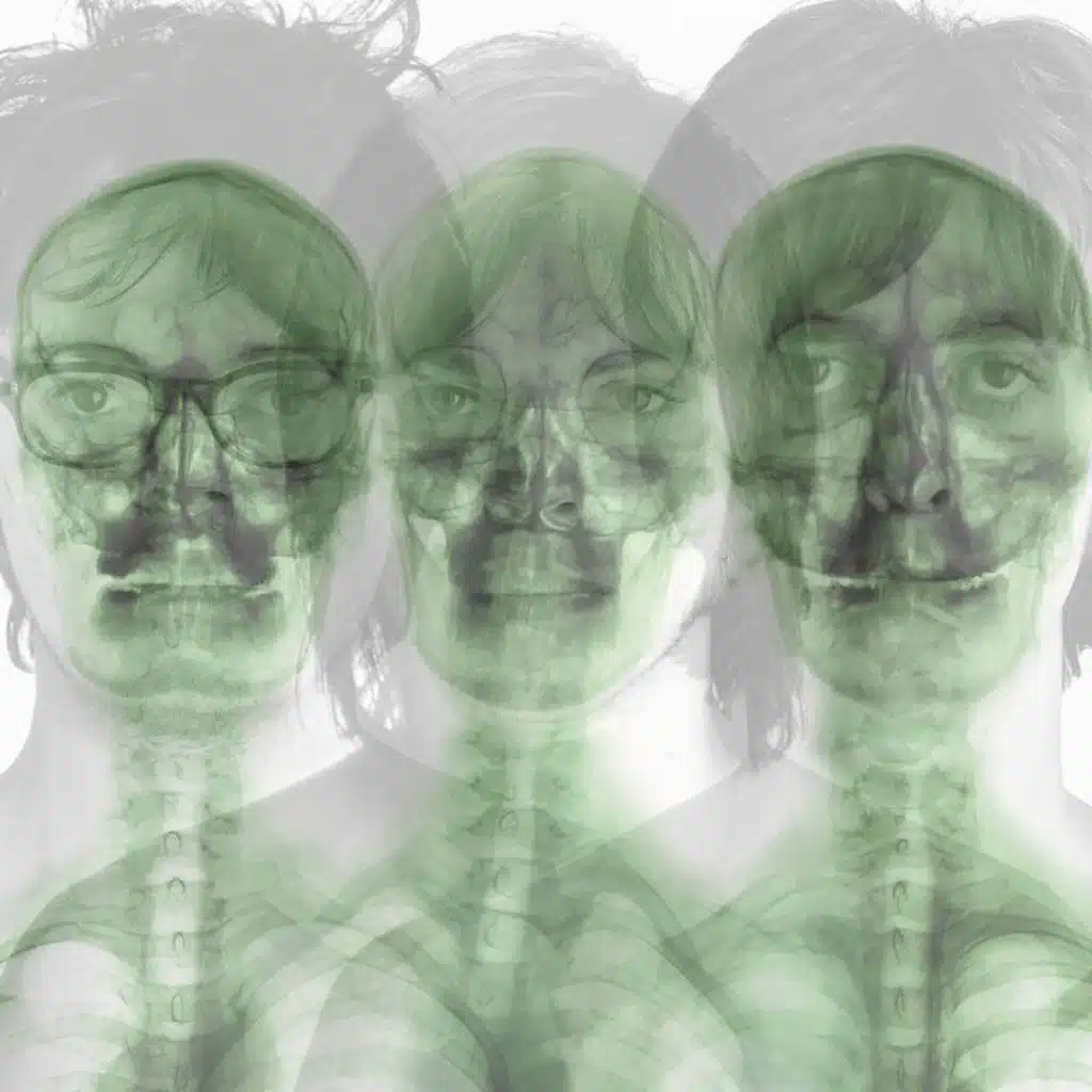 Supergrass (Remastered 2022)