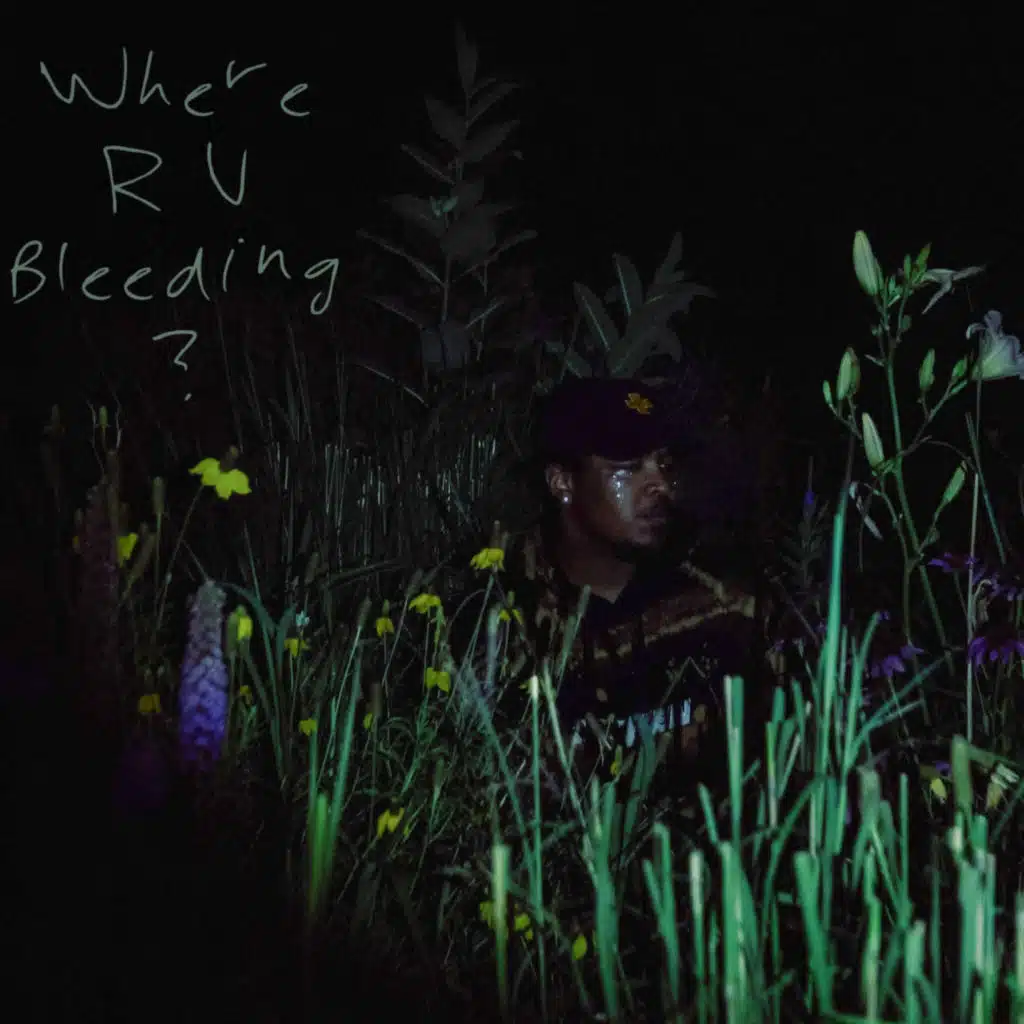 Where are you bleeding?