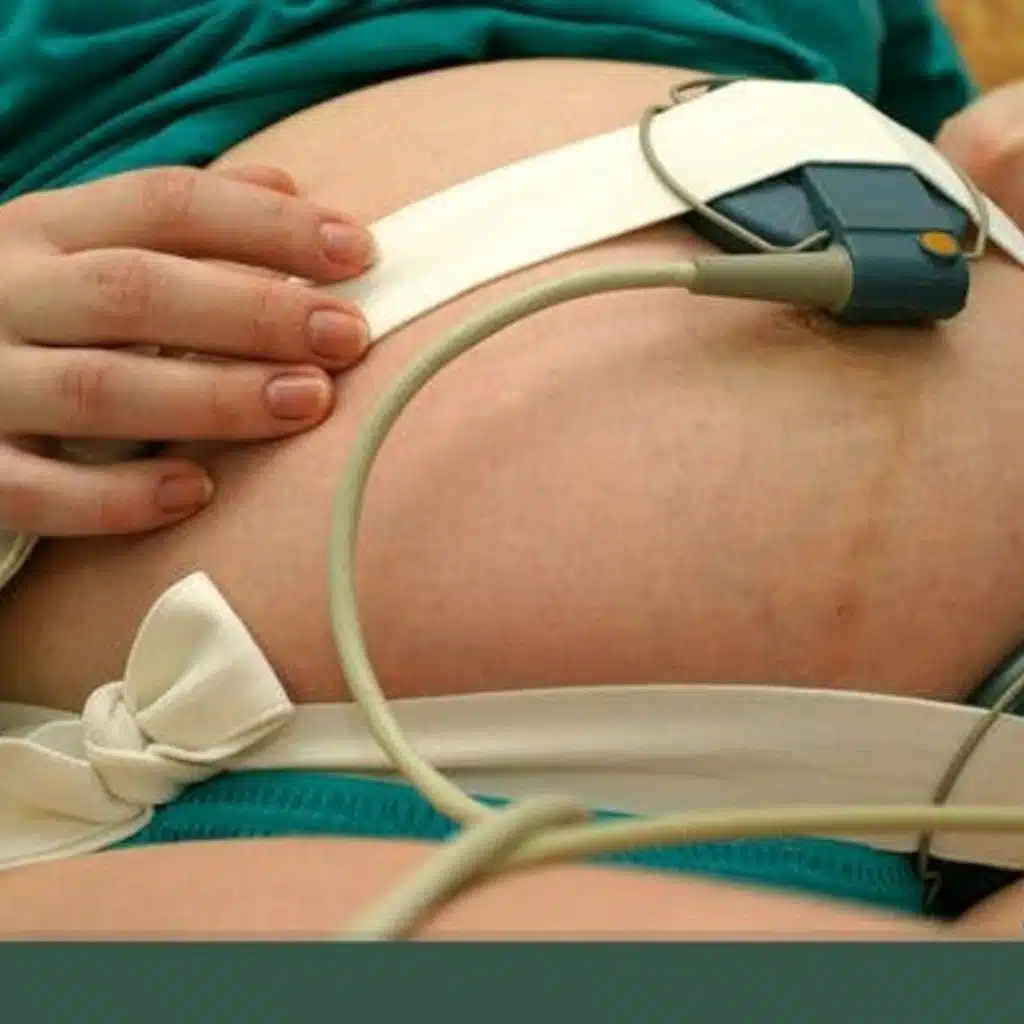 Fetal Non-Stress Tests During Pregnancy