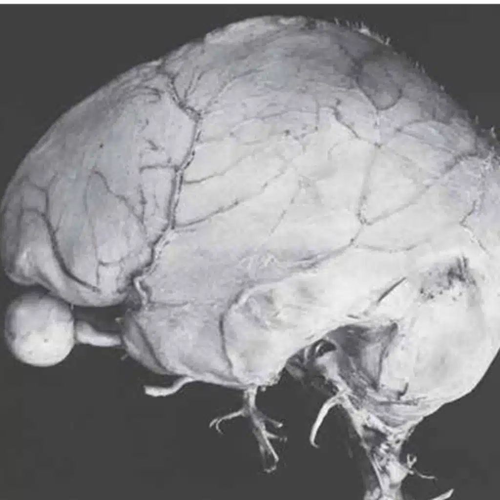 The Brain's Blueprint: From Simple Tube to Conscious Cortex (Section 1)
