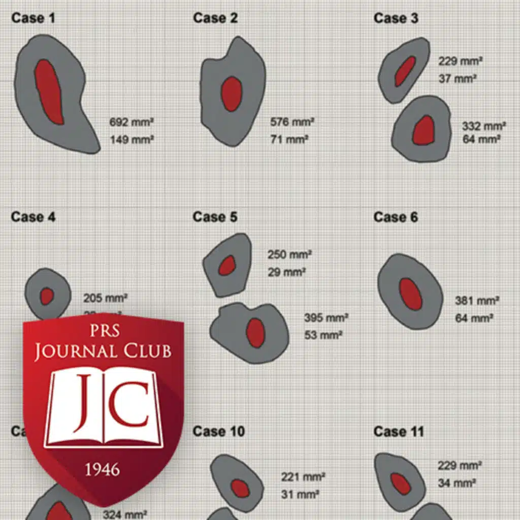 "Total Ear Reconstruction" with Scott P. Bartlett, MD - Feb. 2026 Journal Club