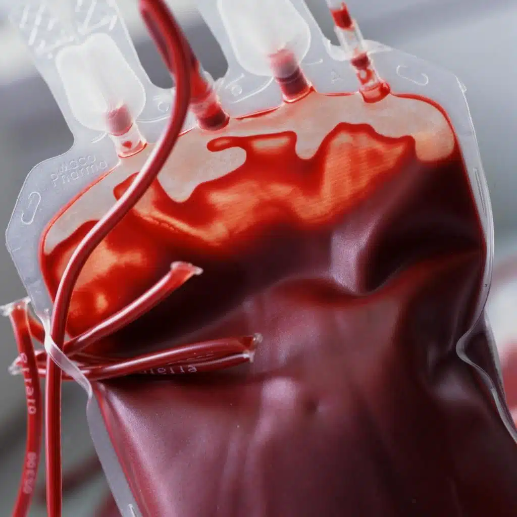 Ein halber Liter Blut - Die Geschichte der Bluttransfusion