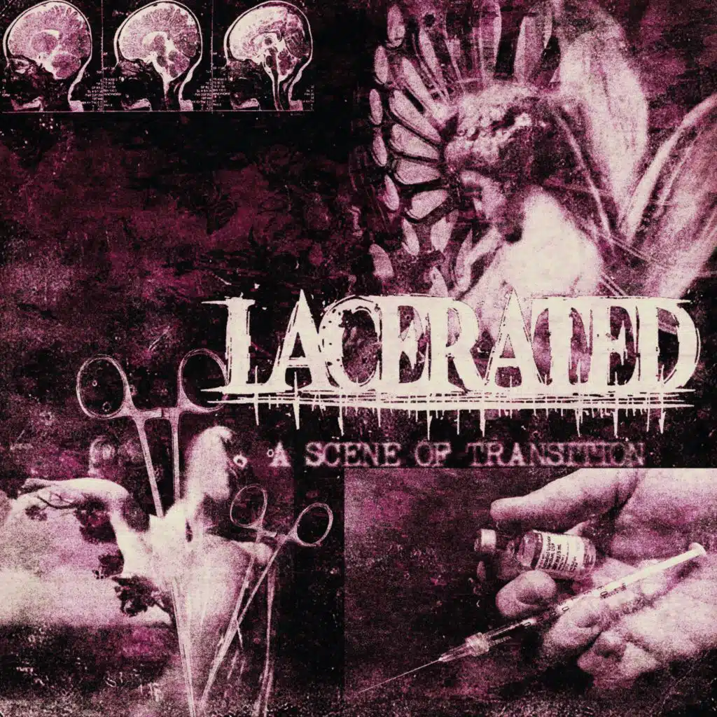 Lacerated