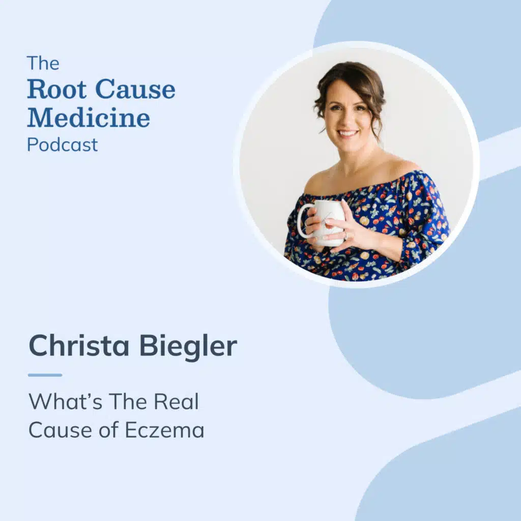 What’s The Real Cause of Eczema with Christa Biegler: Episode Rerun