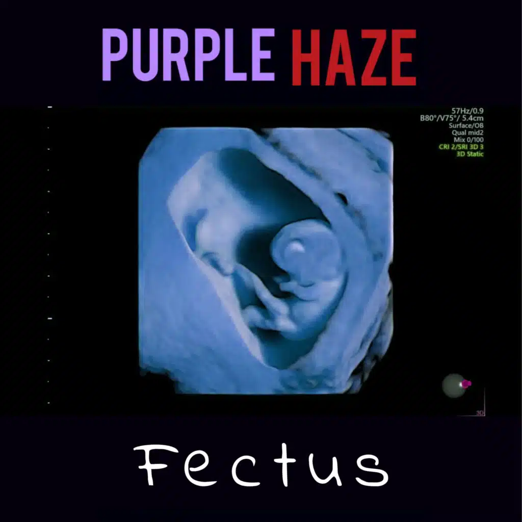 Fectus