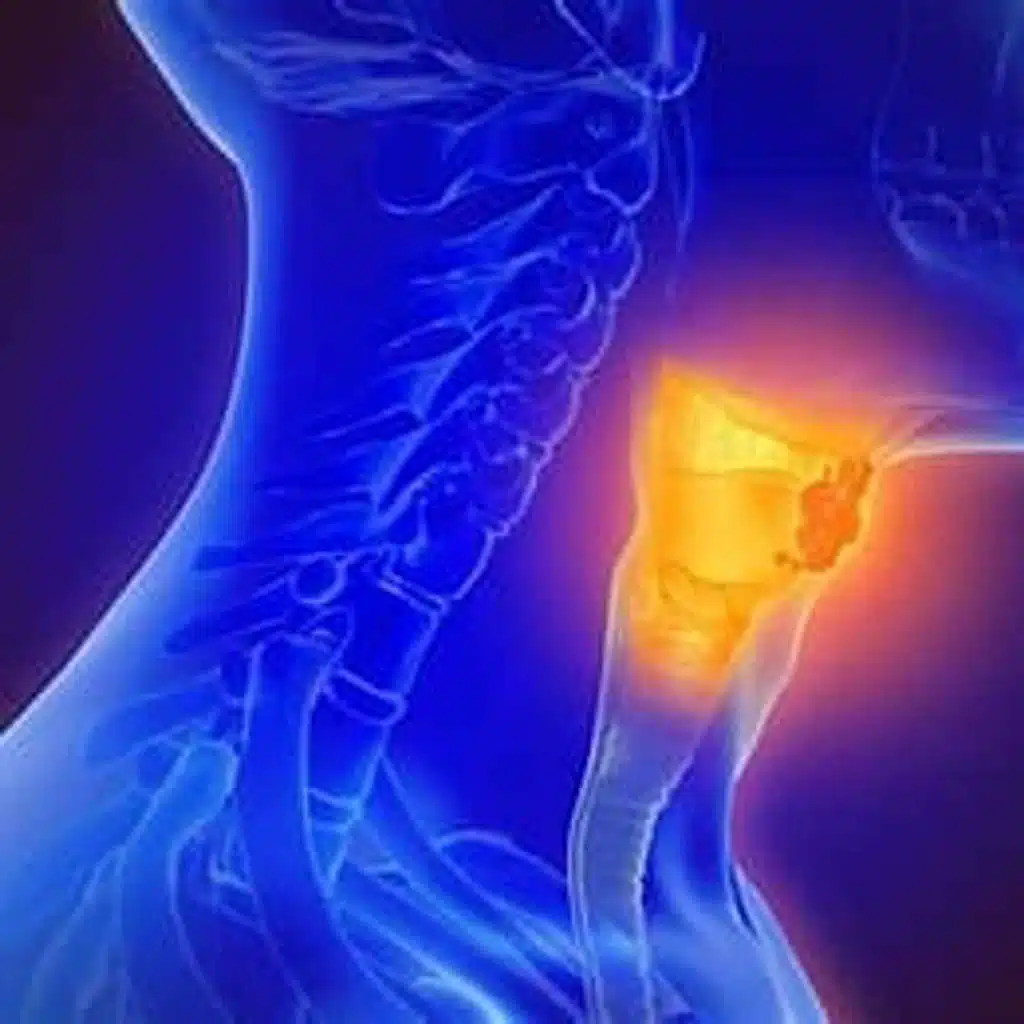 Kelly & Cindy Davidson - Throat Cancer