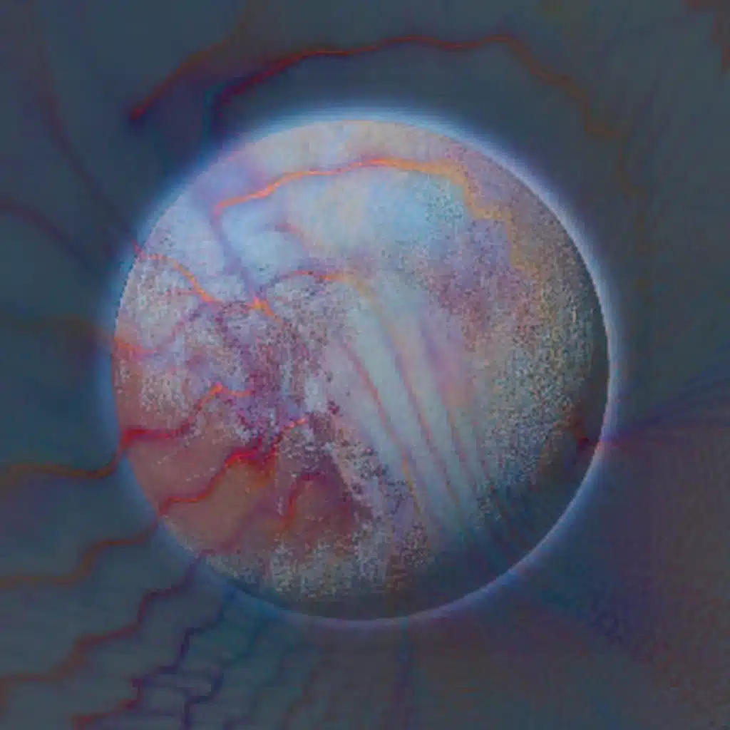 Andromeda