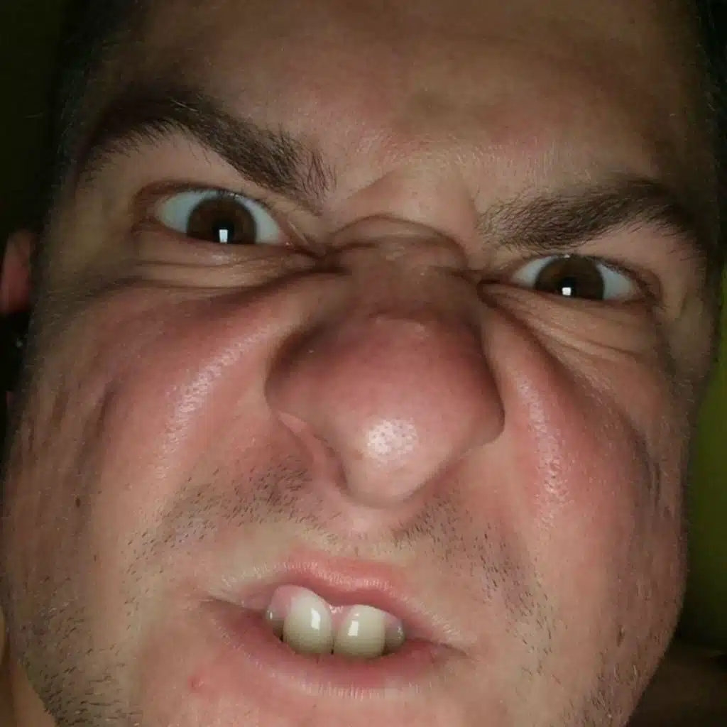 iMVD