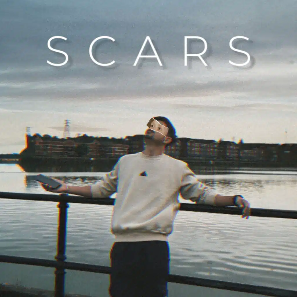 Scars