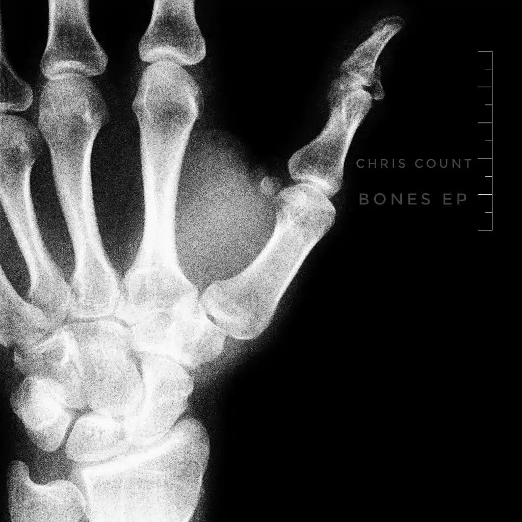 Bones EP