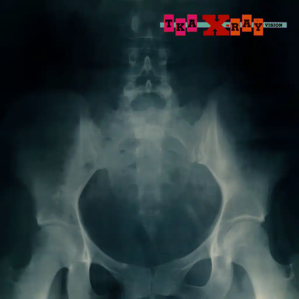 X-Ray Vision