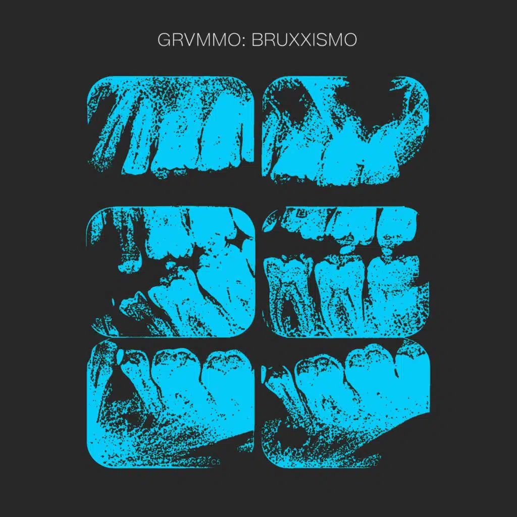 Bruxxismo
