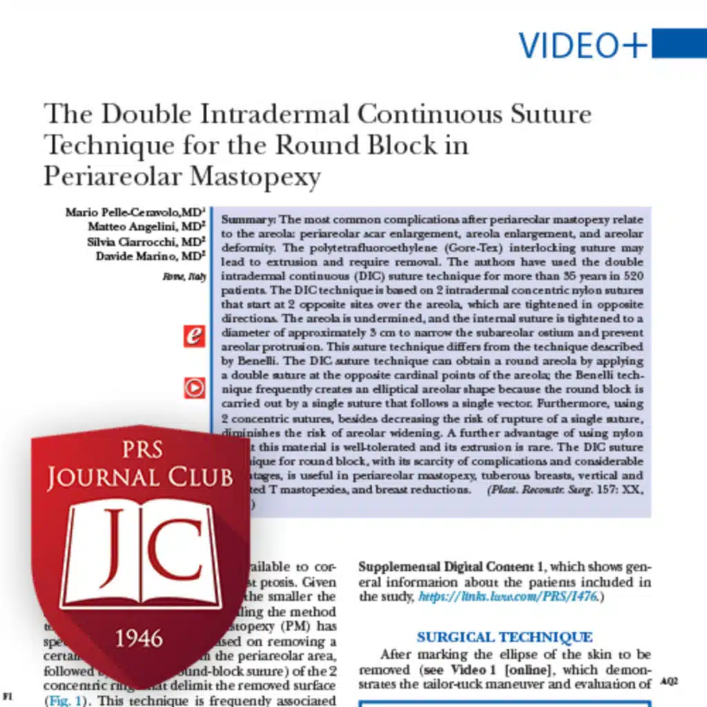 "Multiperforator Autologous Breasts" with Devinder Singh, MD - Jun. 2026 Journal Club