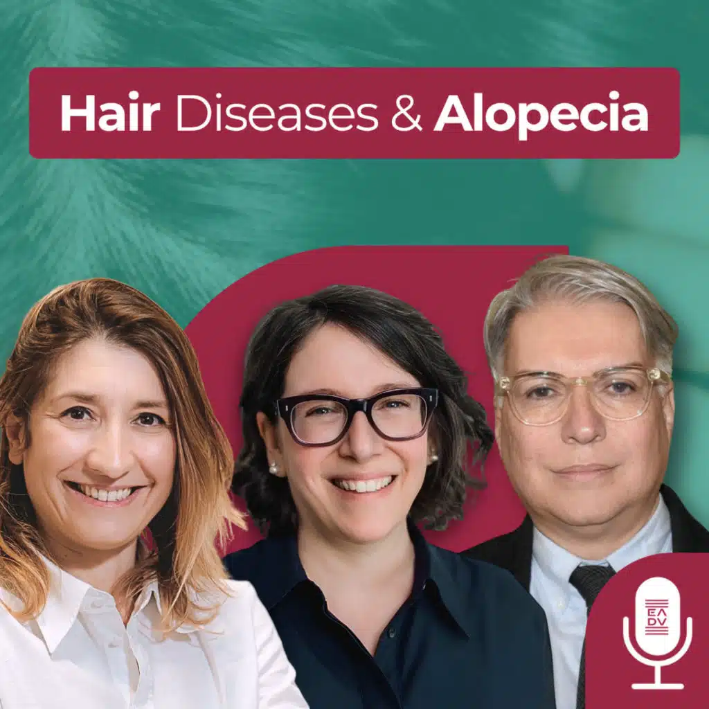 EDU2607 | Hair Diseases and Alopecia: Insights from the EADV Hair Diseases Task Force