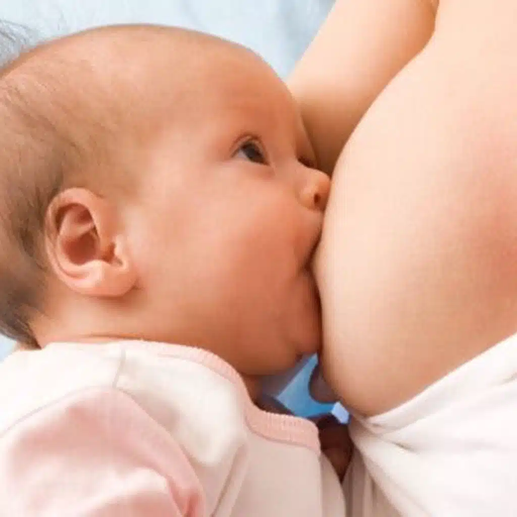 Breastfeeding the Jaundice Baby