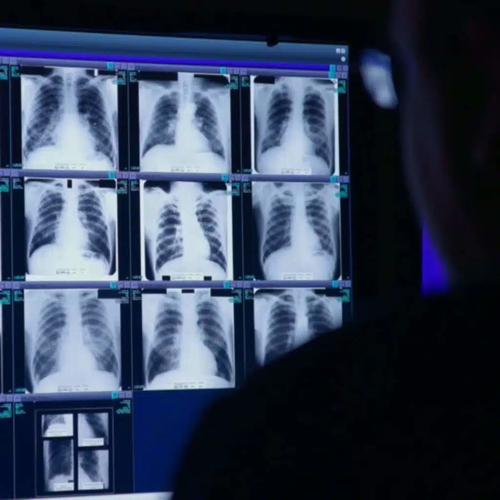 The black lung crisis deepens in Appalachia