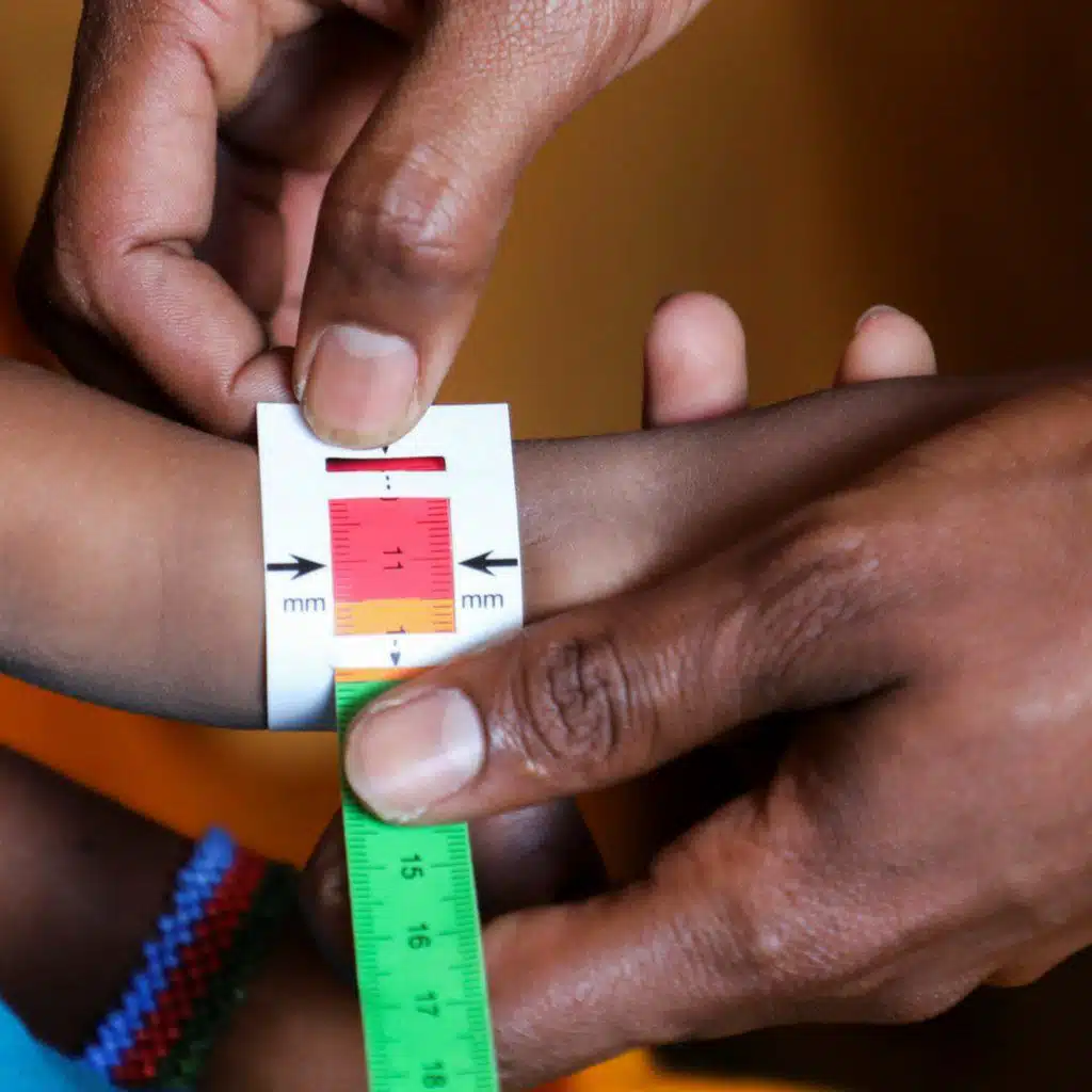 Somalia: Humanitarian agency warns malnutrition