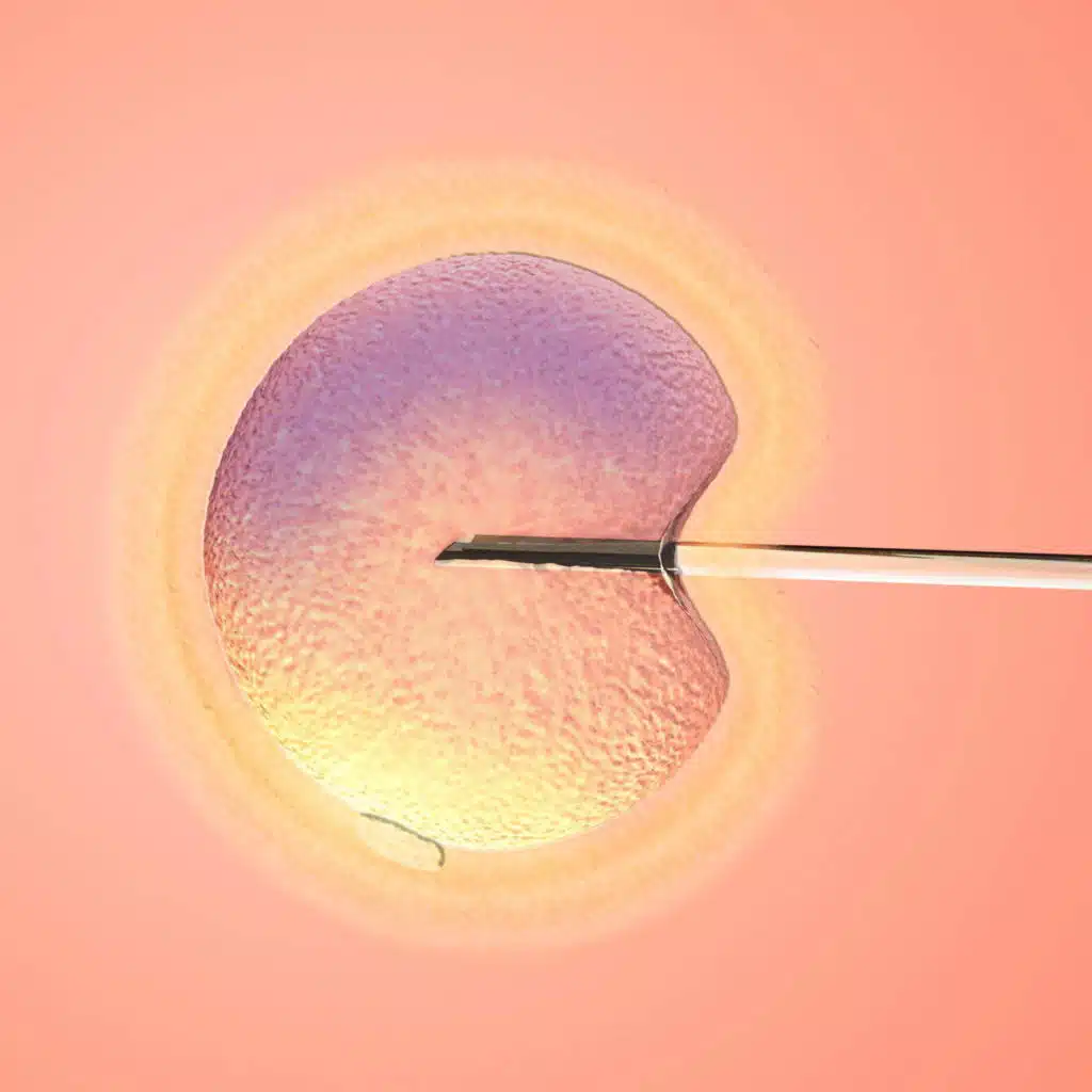 Is IVF actually right for you?