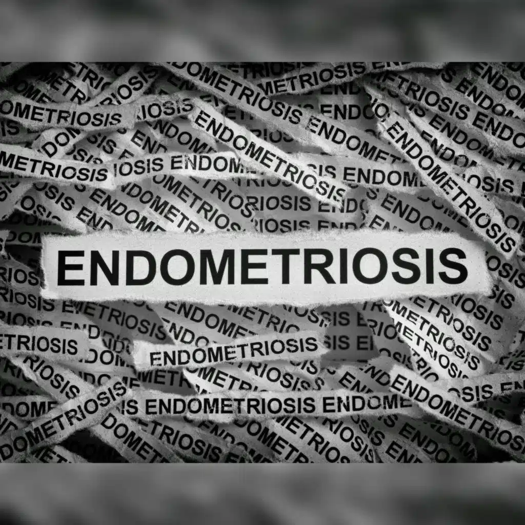 Survey finds endometriosis diagnosis wait times at 14 years on average!