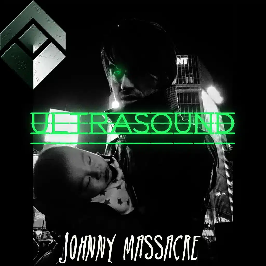 Ultrasound