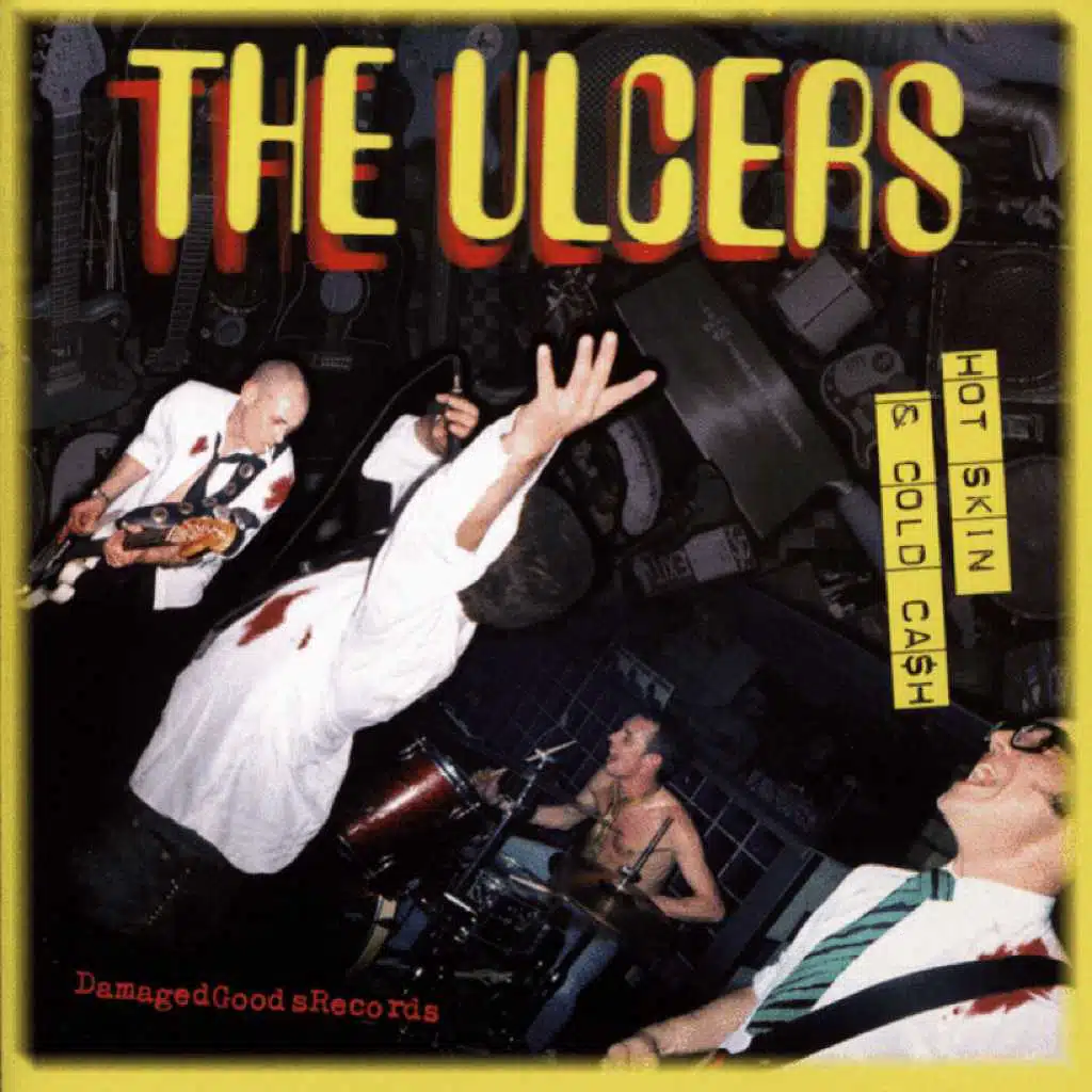 The Ulcers