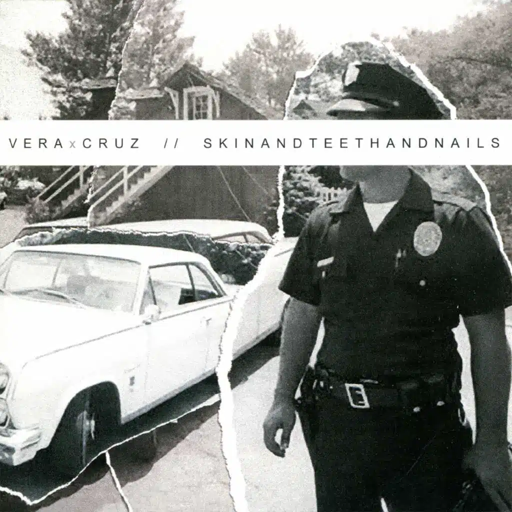 SkinandTeethandNails