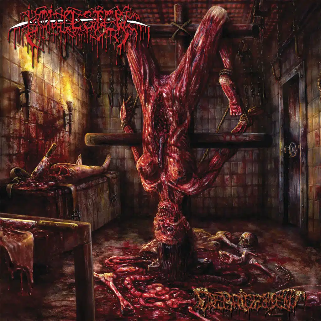 Debridement