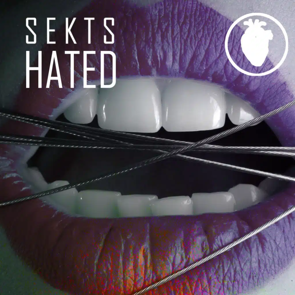 Sekts