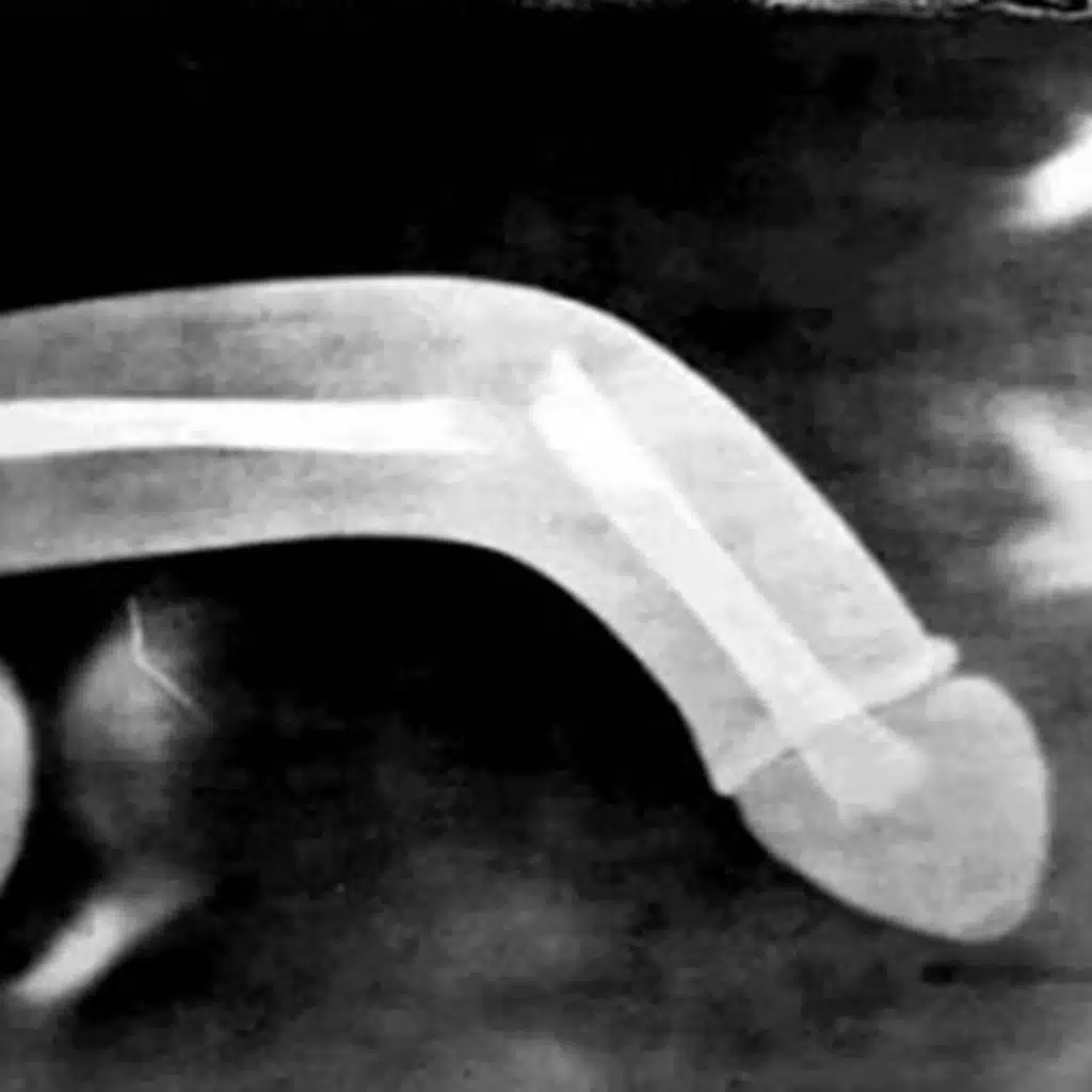 Ichida mini kamera bilan jinsiy aloqa video